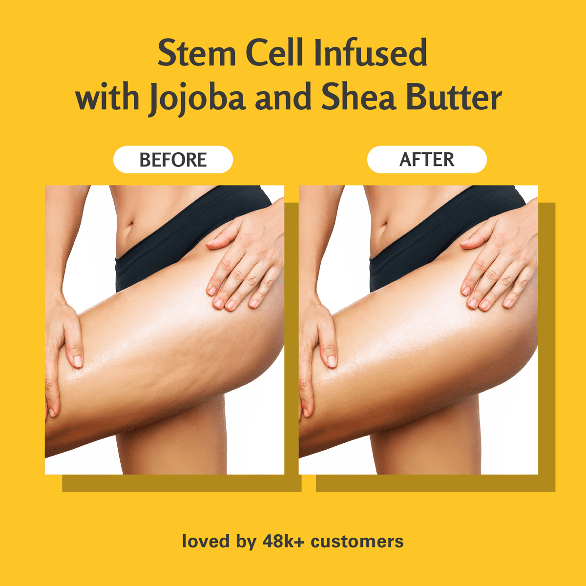 Before and after comparison of legs showing the anti-cellulite results