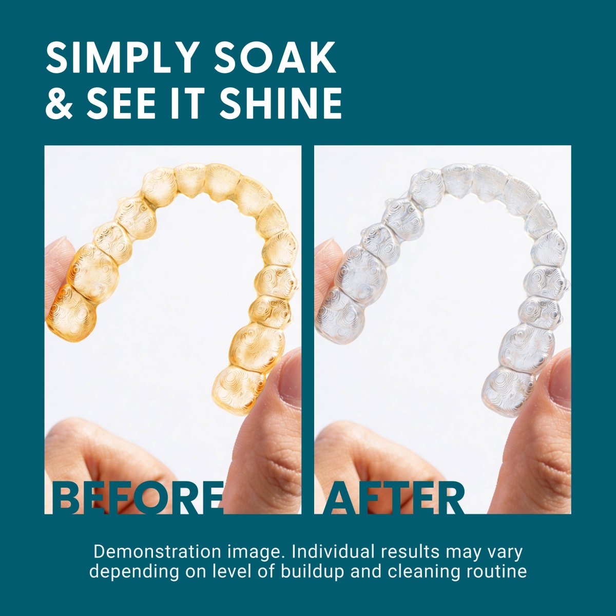 Dental Guard & Retainer Cleaning Kit