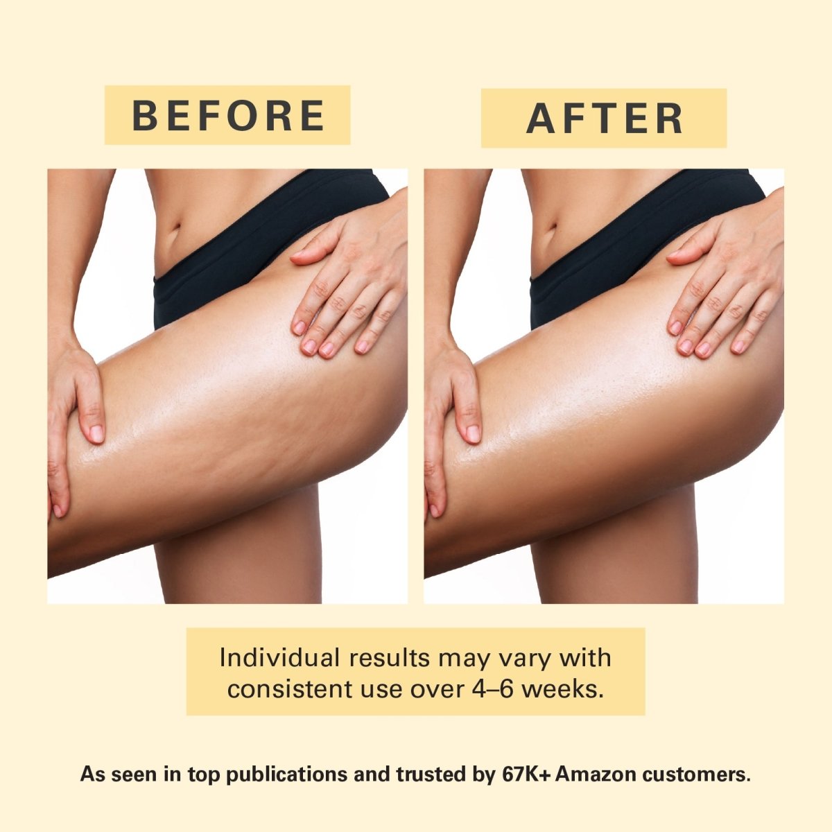 Anti Cellulite Oil + Massager Kit