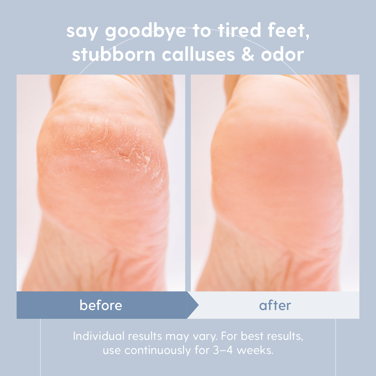 Sore Muscle Foot Soak, 16oz