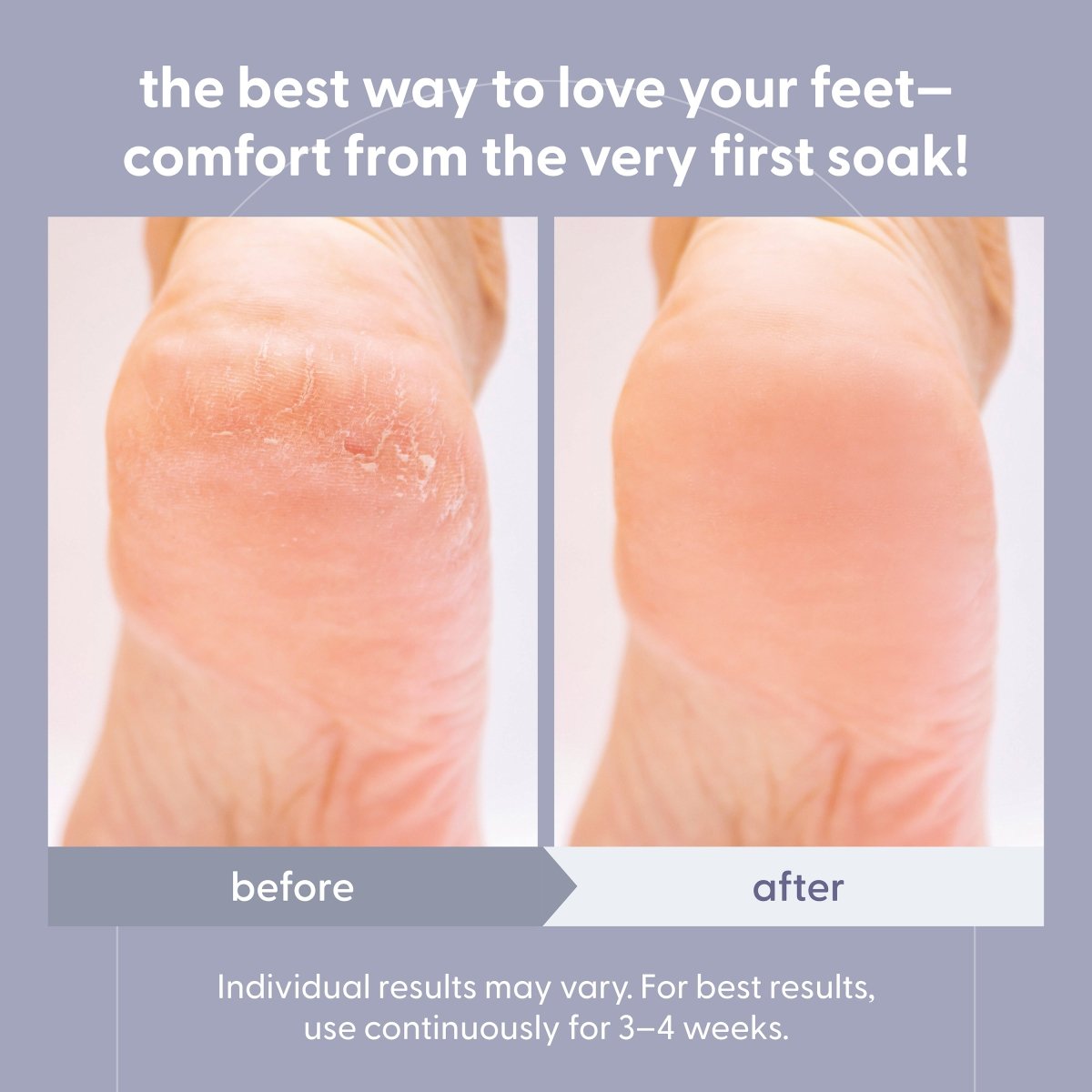 Soothe & Relax Foot Soak, 16oz
